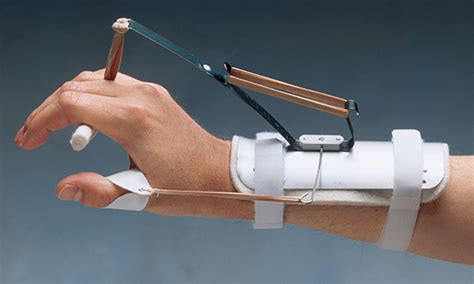 Bunnell® Splints